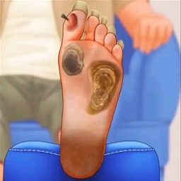 修脚足疔模拟器完整版