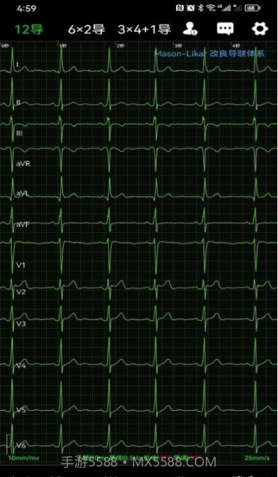 心电一张网截图4