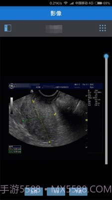 健康格子截图2 健康格子截图2
