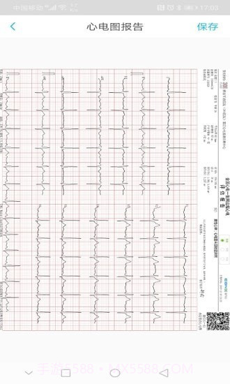 爱心电截图4 爱心电截图4