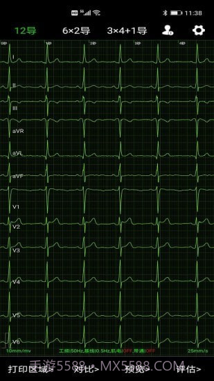 爱心电截图2 爱心电截图2