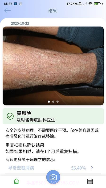 医用皮肤镜影像处理软件免费正版截图4 医用皮肤镜影像处理软件免费正版截图4